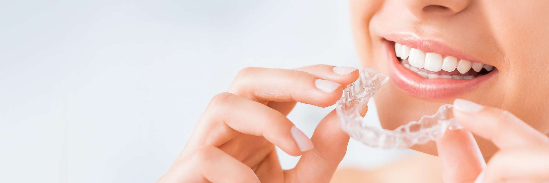 Clear Aligners | Dentist