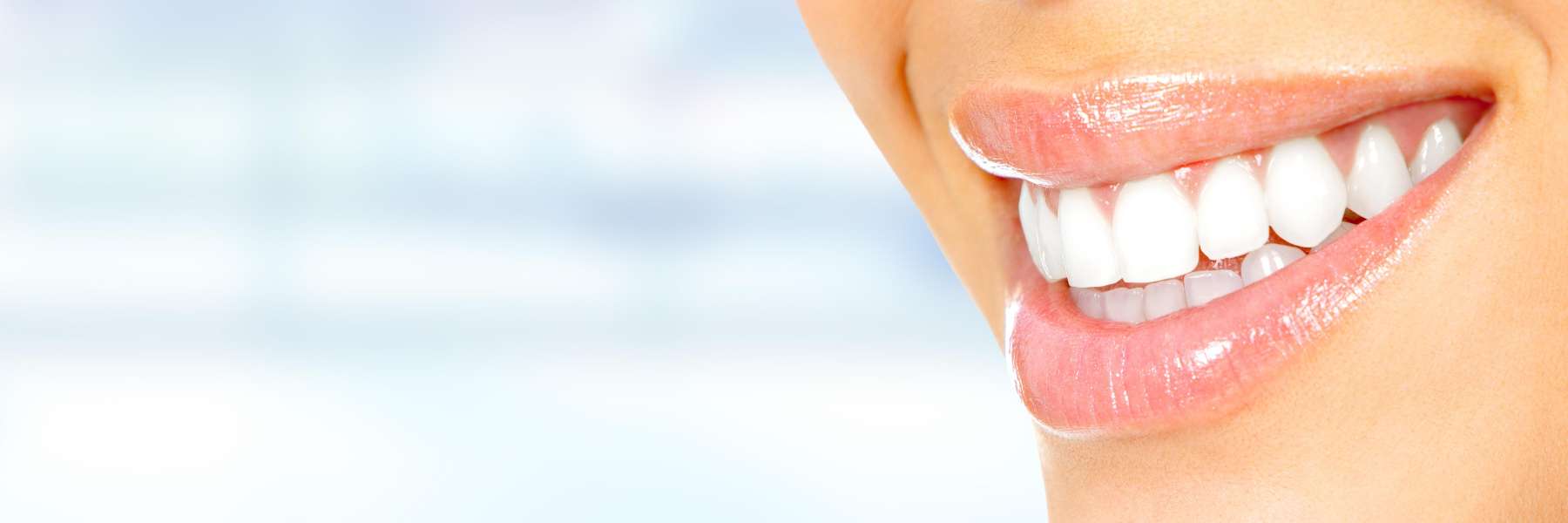 Dental Veneers | Dentist